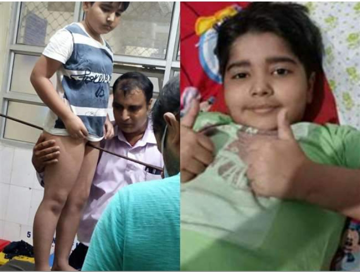 चार फीट का सरिया शरीर में घुसने पर भी दस साल के रुद्राक्ष ने नहीं हारी हिम्‍मत, PGI में सफल आपरेशन