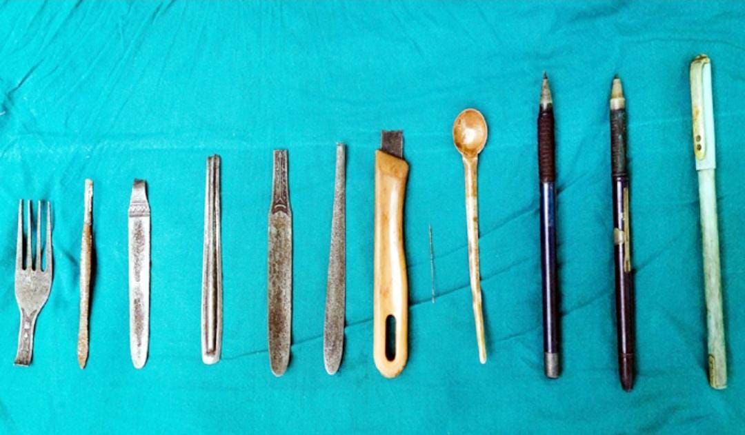 हिमाचल में युवक ने पेट को बनाया स्टोर रूम- डॉक्टर ने पैन और चम्मच जैसी 12 चीजें निकाली
