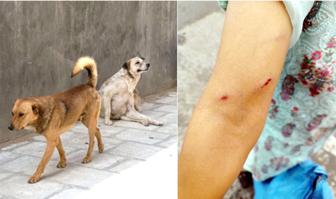 शिमला में आवारा कुत्तों का कहर, ड्यूटी पर तैनात महिला सफाई कर्मचारी पर किया हमला